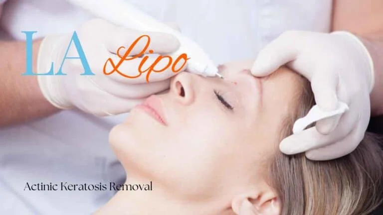 Woman receiving Actinic Keratosis Removal Treatment Sudbury