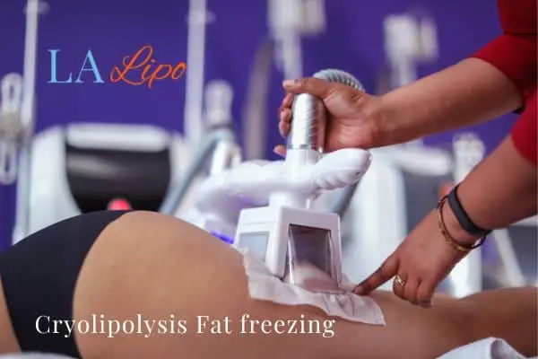 women getting fat freezing Sudbury