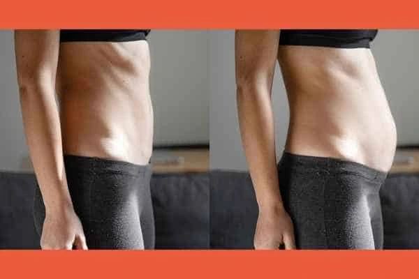 LA-EMS Body Sculpting results Sudbury