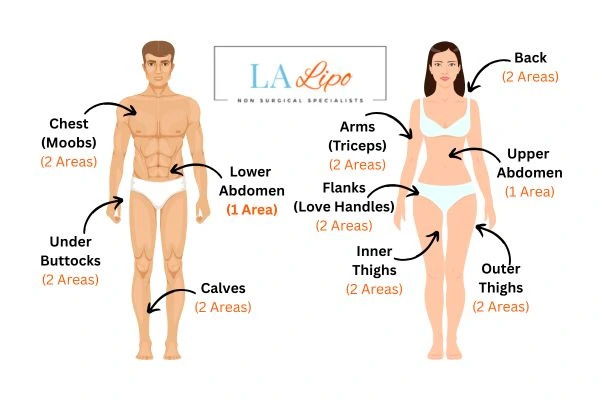 LA LIPO Cryolipolysis Areas Sudbury