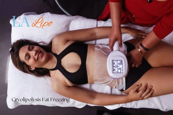 woman getting cryolipolysis Sudbury