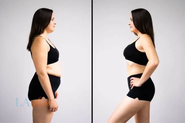 link between body image and mental health Sudbury