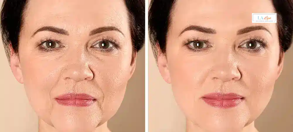 How Long Does It Take to See Results and How Long Do They Last Sudbury?