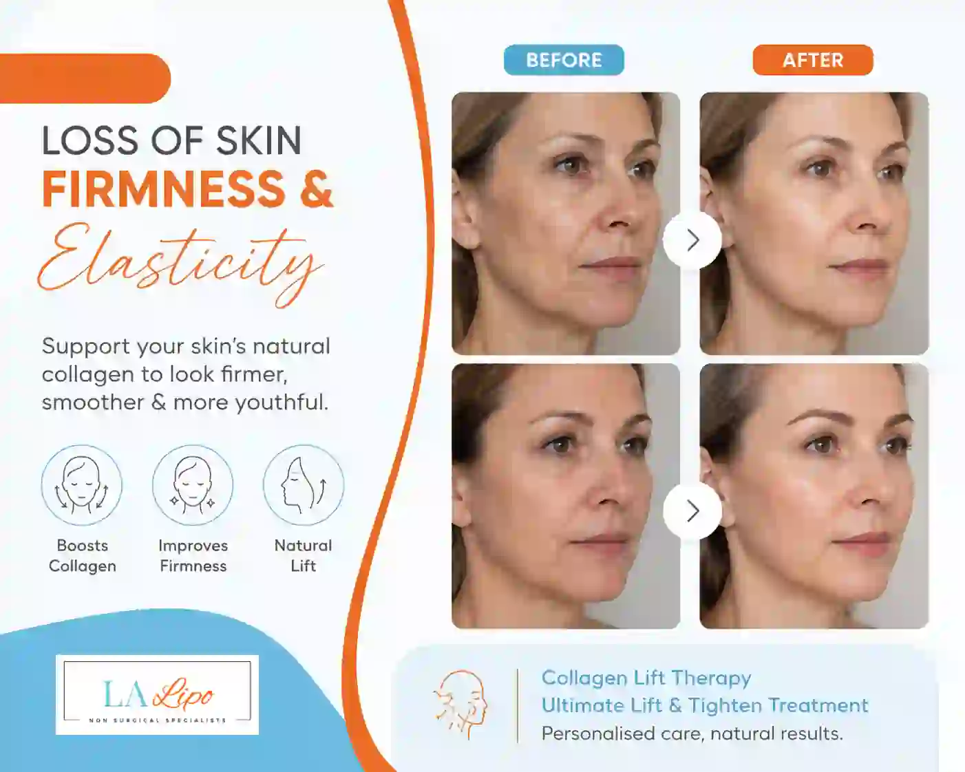 Sign #7: Loss of Skin Firmness and Elasticity Sudbury